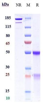 PD-L1 (CD274) (Manelimab Biosimilar) Antibody in SDS-PAGE (SDS-PAGE)