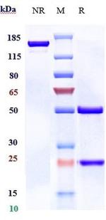 CD275 (B7-H2) (Prezalumab Biosimilar) Antibody in SDS-PAGE (SDS-PAGE)
