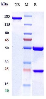 Nimacimab Antibody in SDS-PAGE (SDS-PAGE)