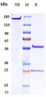 IL-25 Humanized Biosimilar Recombinant Human Monoclonal Antibody