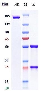 CD19 (Coltuximab Biosimilar) Antibody in SDS-PAGE (SDS-PAGE)