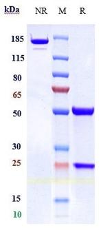Concizumab Humanized Antibody in SDS-PAGE (SDS-PAGE)