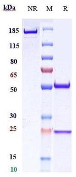 CD20 (Ripertamab Biosimilar) Antibody in SDS-PAGE (SDS-PAGE)