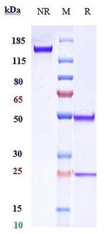CD20 (Biosimilar) Antibody in SDS-PAGE (SDS-PAGE)
