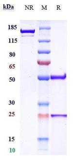 CD20 (Ublituximab Biosimilar) Antibody in SDS-PAGE (SDS-PAGE)