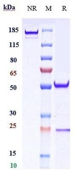 CD20 (Veltuzumab Biosimilar) Antibody in SDS-PAGE (SDS-PAGE)