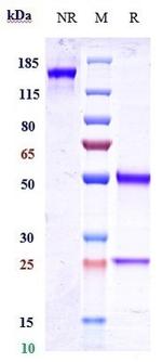 CD20 (Zuberitamab Biosimilar) Antibody in SDS-PAGE (SDS-PAGE)