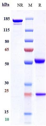 CD4 Humanized Biosimilar Recombinant Human Monoclonal Antibody