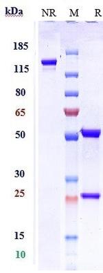 IL-5 (Depemokimab Biosimilar) Recombinant Human Monoclonal Antibody
