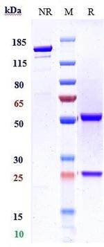 CD20 (Divozilimab Biosimilar) Antibody in SDS-PAGE (SDS-PAGE)