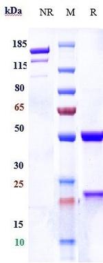 P-cadherin Biosimilar Antibody in SDS-PAGE (SDS-PAGE)