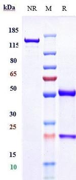 Ebdarokimab Humanized Antibody in SDS-PAGE (SDS-PAGE)