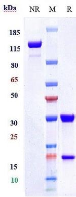CD66e (CEACAM5) (Tusamitamab Biosimilar) Antibody in SDS-PAGE (SDS-PAGE)