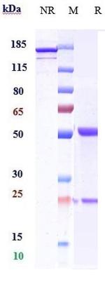 Enoticumab Antibody in SDS-PAGE (SDS-PAGE)