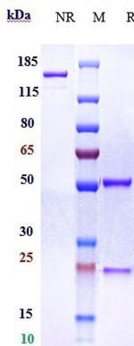 Lampalizumab Humanized Antibody in SDS-PAGE (SDS-PAGE)