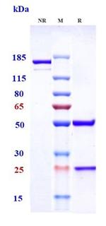 TNF alpha (Biosimilar) Antibody in SDS-PAGE (SDS-PAGE)