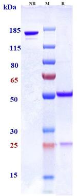 CSF1R (CD115) (Biosimilar) Antibody in SDS-PAGE (SDS-PAGE)