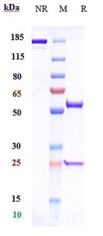 Gimsilumab Antibody in SDS-PAGE (SDS-PAGE)