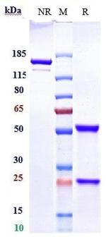 SGPP1 Biosimilar Recombinant Human Monoclonal Antibody