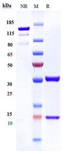 IL-8 Biosimilar Recombinant Human Monoclonal Antibody