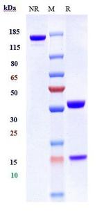 CXCR4 (CD184) Biosimilar Recombinant Human Monoclonal Antibody