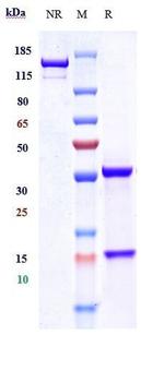 PLXDC2 Biosimilar Recombinant Human Monoclonal Antibody