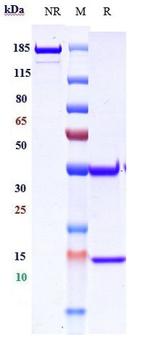 EGFR (Demupitamab Biosimilar) Antibody in SDS-PAGE (SDS-PAGE)