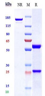 Her-3 (ErbB3) (Barecetamab Biosimilar) Antibody in SDS-PAGE (SDS-PAGE)