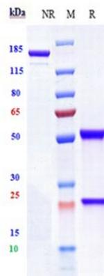 Her-3 (ErbB3) (Lumretuzumab Biosimilar) Antibody in SDS-PAGE (SDS-PAGE)