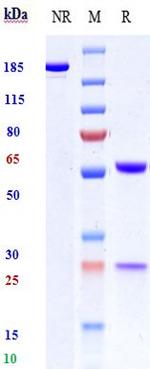 CD19 (Biosimilar) Antibody in SDS-PAGE (SDS-PAGE)