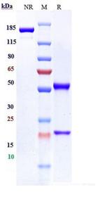 FcRL5 (Biosimilar) Recombinant Humanized mouse Monoclonal Antibody