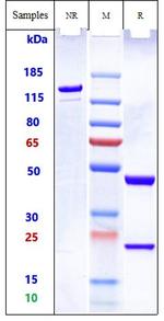 Pelgifatamab Recombinant Human Monoclonal Antibody