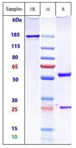 PD-1 (CD279) (Iparomlimab Biosimilar) Antibody in SDS-PAGE (SDS-PAGE)