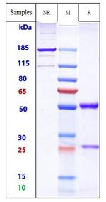 hu14.18-IL2 Humanized Biosimilar Antibody in SDS-PAGE (SDS-PAGE)