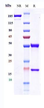 beta Amyloid (Biosimilar) Antibody in SDS-PAGE (SDS-PAGE)