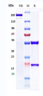 c-Met Biosimilar Antibody in SDS-PAGE (SDS-PAGE)