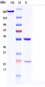 c-Met Biosimilar Recombinant Human Monoclonal Antibody