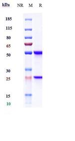 beta Amyloid Biosimilar Antibody in SDS-PAGE (SDS-PAGE)