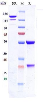 ICAM-1 (CD54) (Bersanlimab Biosimilar) Antibody in SDS-PAGE (SDS-PAGE)