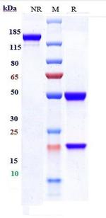 Emapalumab Antibody in SDS-PAGE (SDS-PAGE)