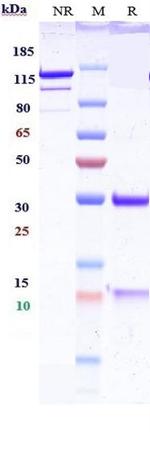 IGF2 Biosimilar Recombinant Human Monoclonal Antibody