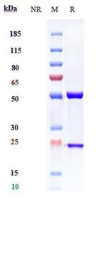 IL-13 Humanized Biosimilar Recombinant Human Monoclonal Antibody