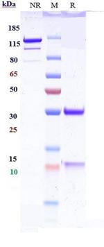 IL-13 Humanized Biosimilar Recombinant Human Monoclonal Antibody