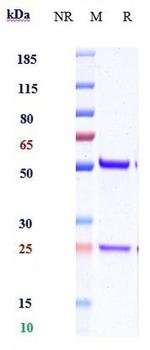 IL-18 Biosimilar Antibody in SDS-PAGE (SDS-PAGE)