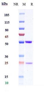 IL-1 beta (Biosimilar) Antibody in SDS-PAGE (SDS-PAGE)
