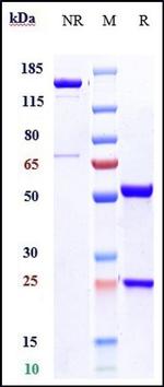 Oxidized LDL Biosimilar Recombinant Human Monoclonal Antibody