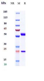 IL-6 Humanized Biosimilar Antibody in SDS-PAGE (SDS-PAGE)