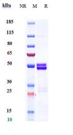 IL-6 (Ziltivekimab Biosimilar) Antibody in SDS-PAGE (SDS-PAGE)