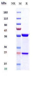 IL-6 (Siltuximab Biosimilar) Antibody in SDS-PAGE (SDS-PAGE)