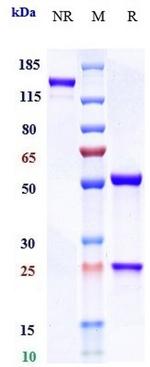 IL-6 (Olokizumab Biosimilar) Antibody in SDS-PAGE (SDS-PAGE)